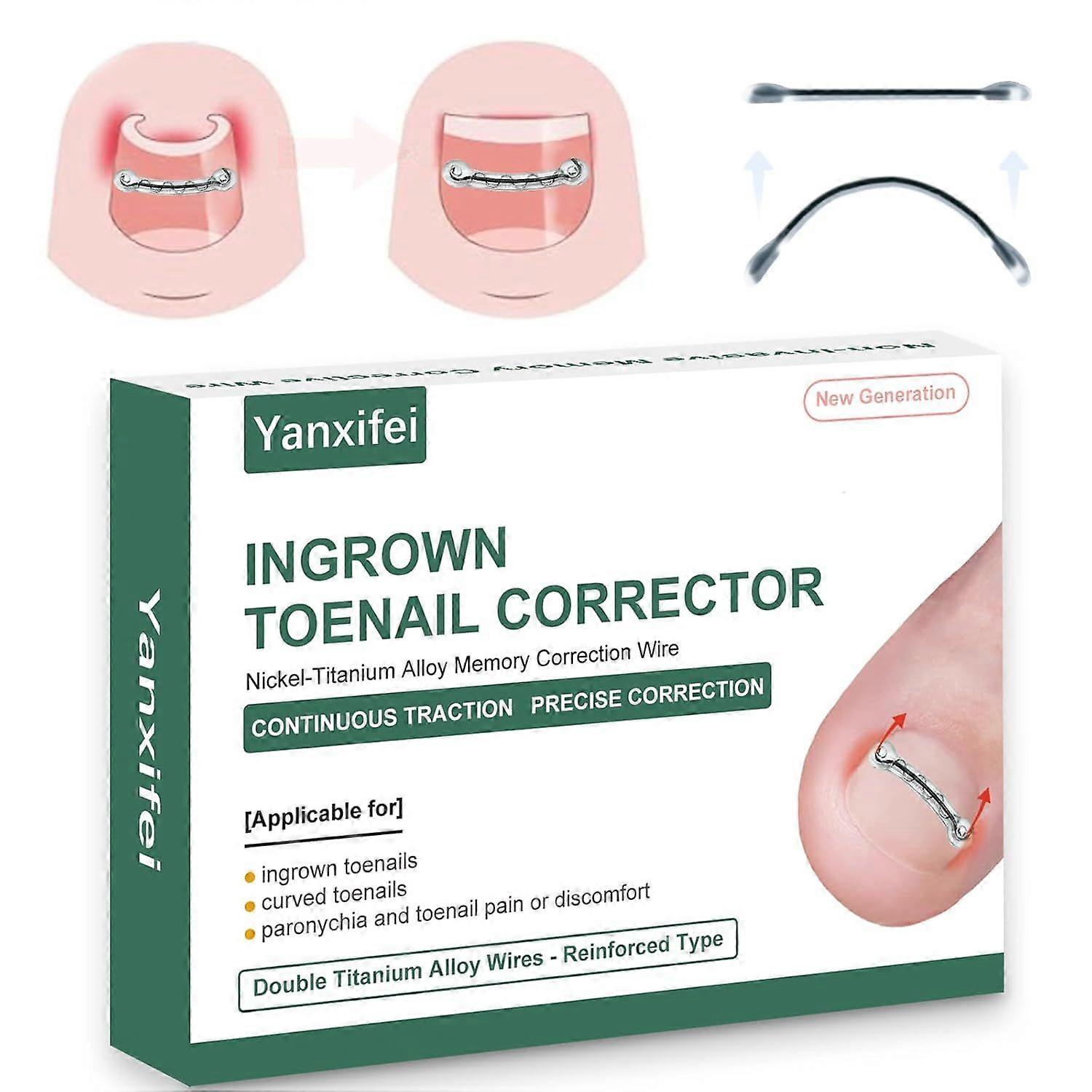 Corrector de uñas encarnadas de nitinol doble, último modelo 2025, uña encarnada