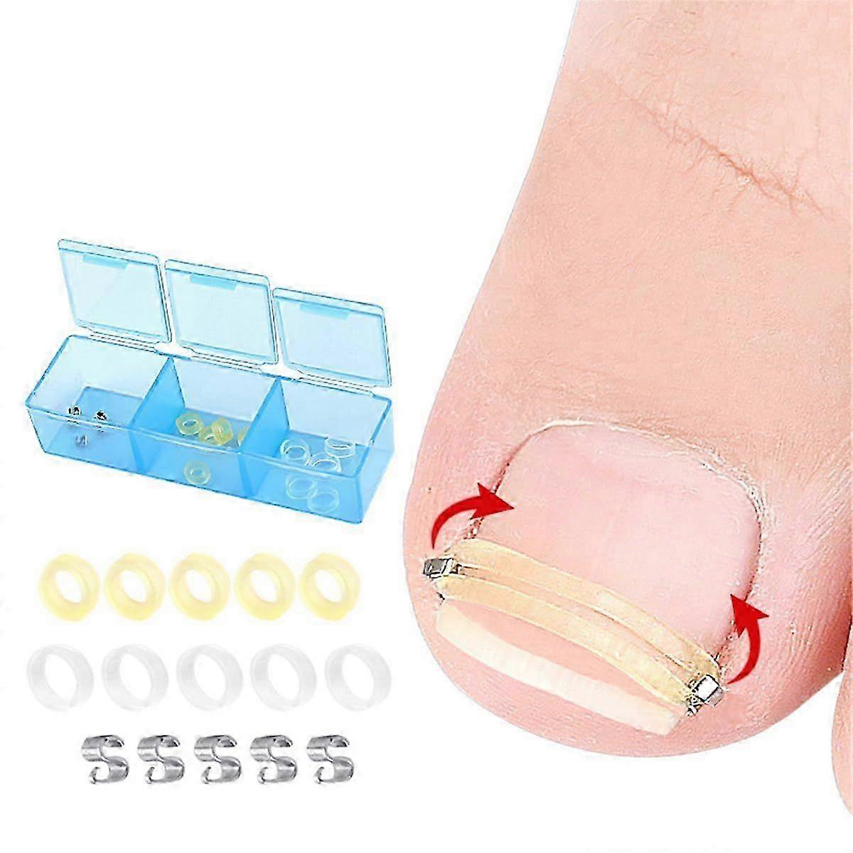 2025 Latest Model Ingrown Toenail Corrector, Stainless Steel Curved Toenail