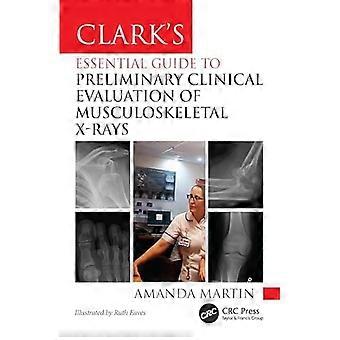 Guide essentiel de Clark pour l'évaluation clinique préliminaire des radiographies musculo-squelettiques