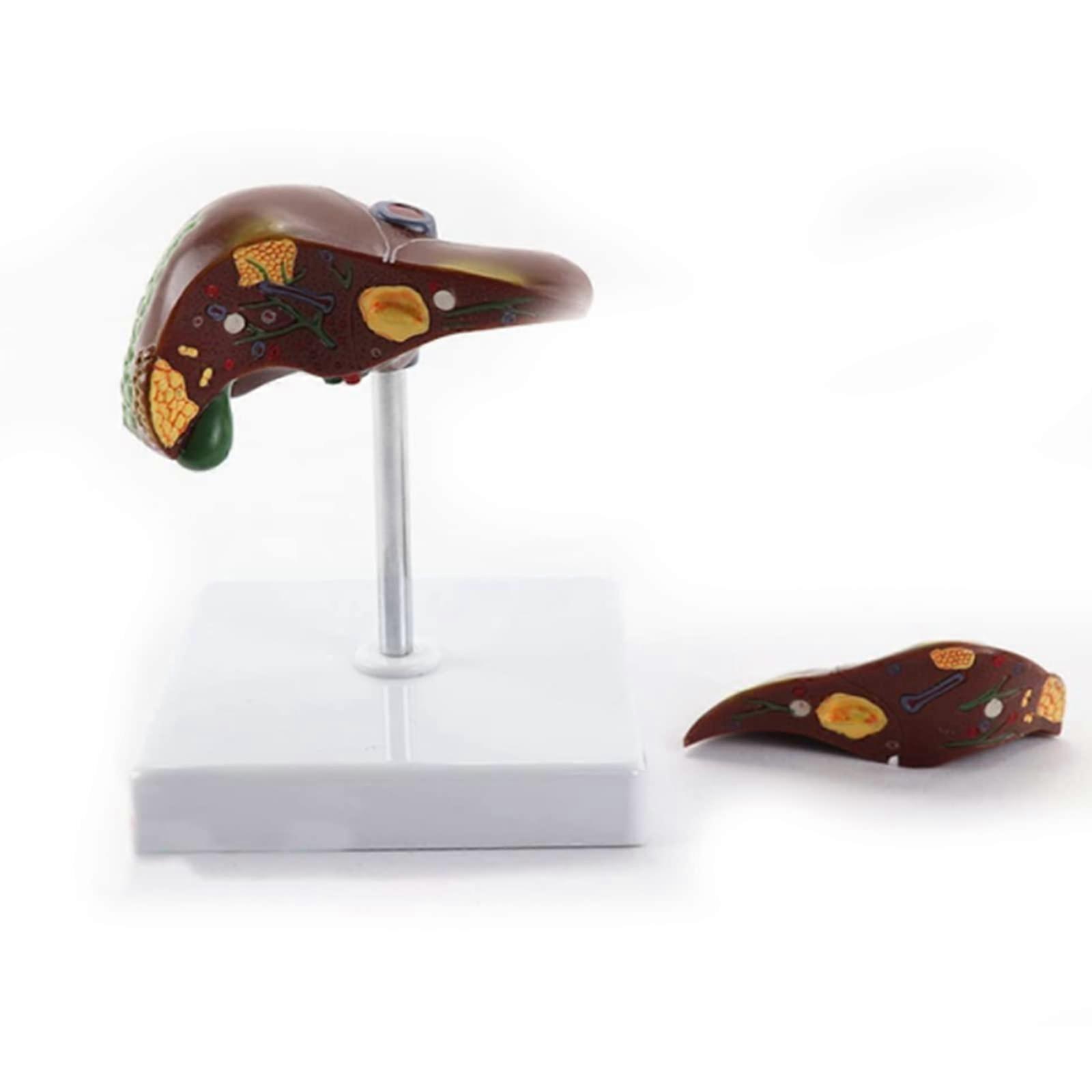 LifeSize Human Liver Anatomy Model with ColorCoded Internal Structures and Mounted Stand for Medical Training