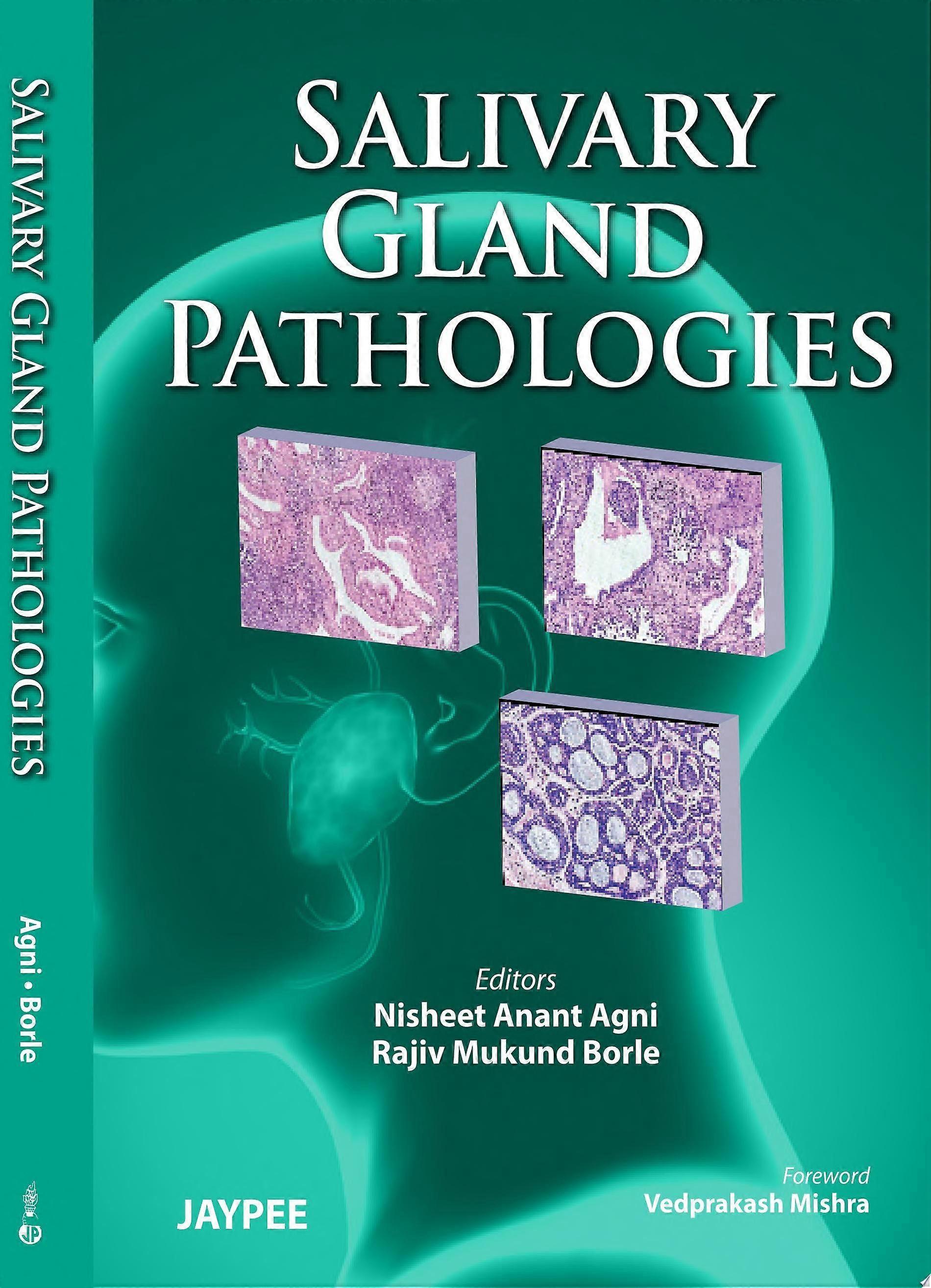 Salivary gland pathologies