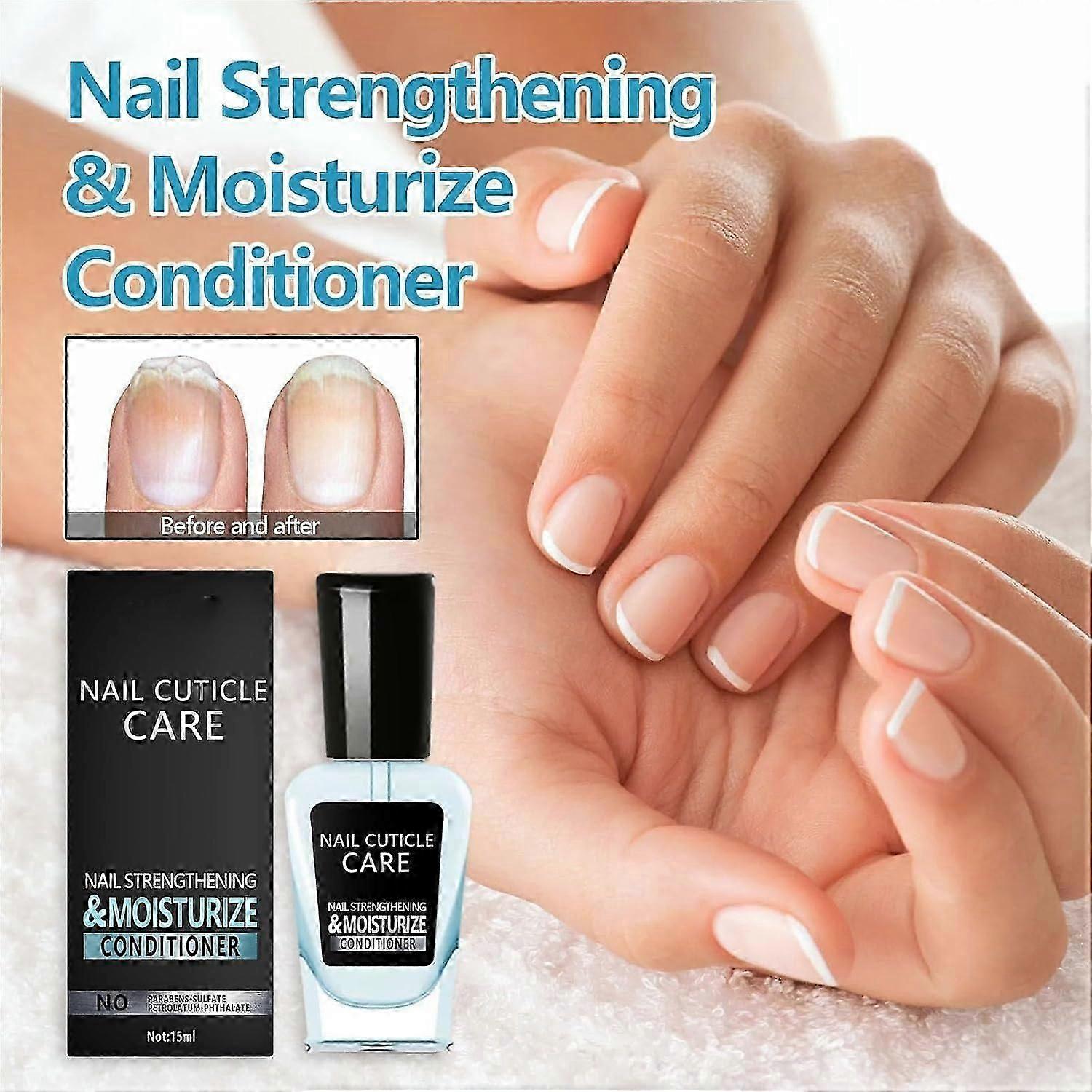 Onycholyse Guérir le renforcement des ongles et le revitalisant de croissance,Traitement des ongles d’onycholyse,Traitements d’onycholyse, Guérison de l’onycholyse, Traitement de l’onycholyse