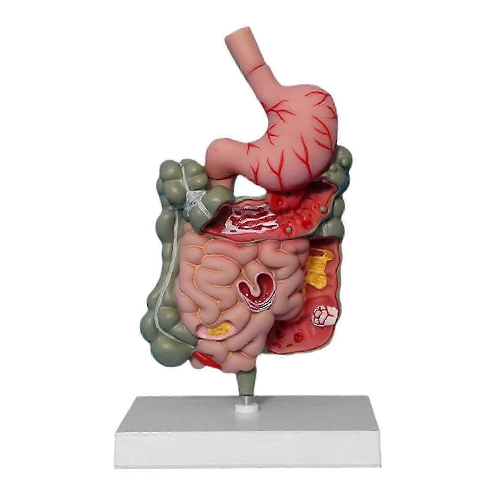 Human Digestive System Model Sturdy Professional Teaching Aids for Classroom 25-26