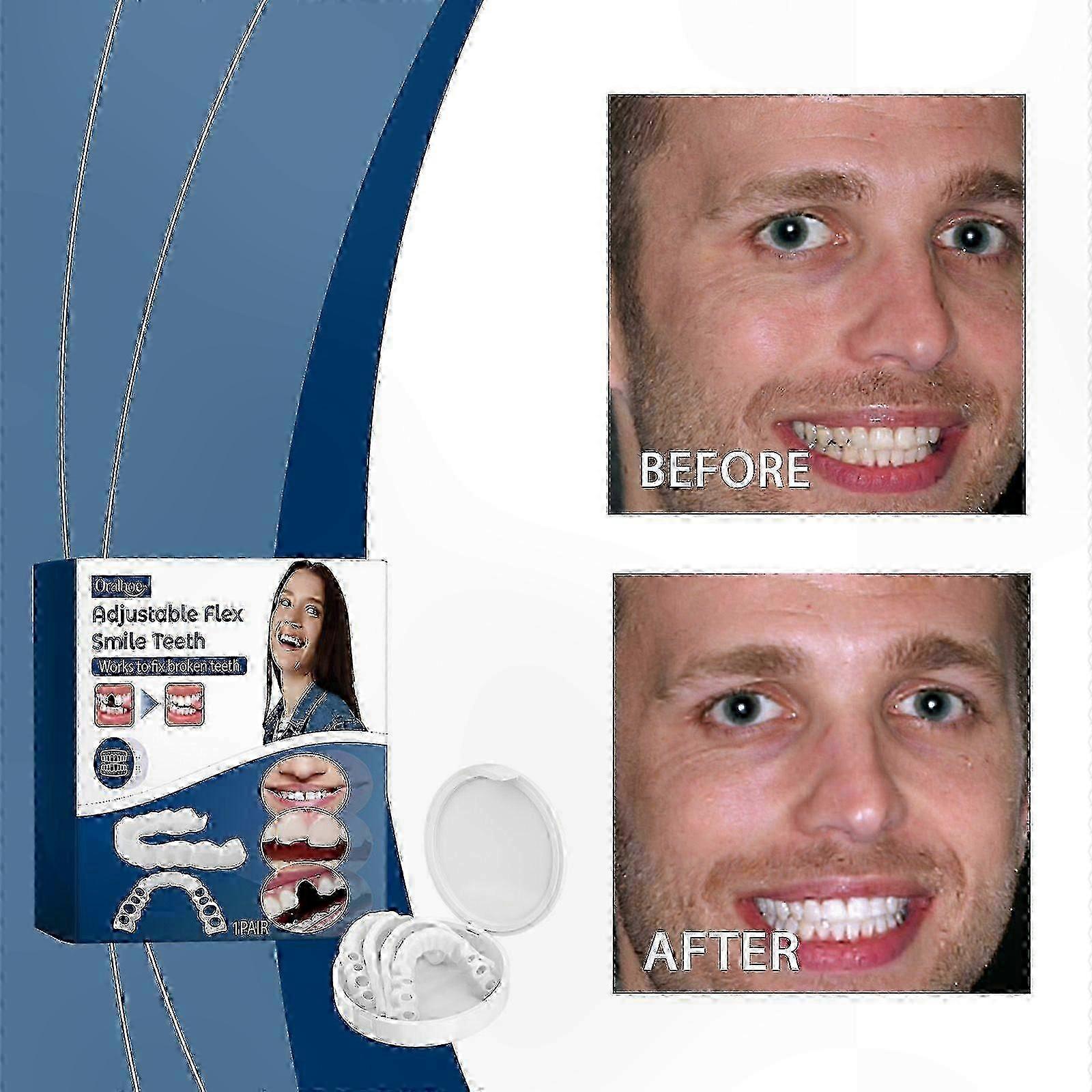 Correct Gaps and Misalignment with Adjustable Silicone Dentures