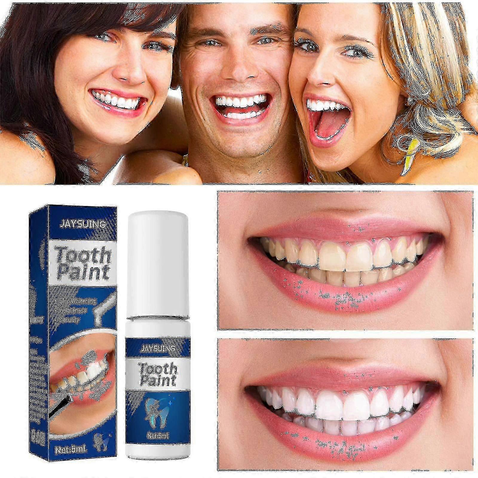 Jaysuing Teeth To Remove Tooth S, Tooth Dirt, Yellow Teeth, Teeth, Cleaning And Tooth