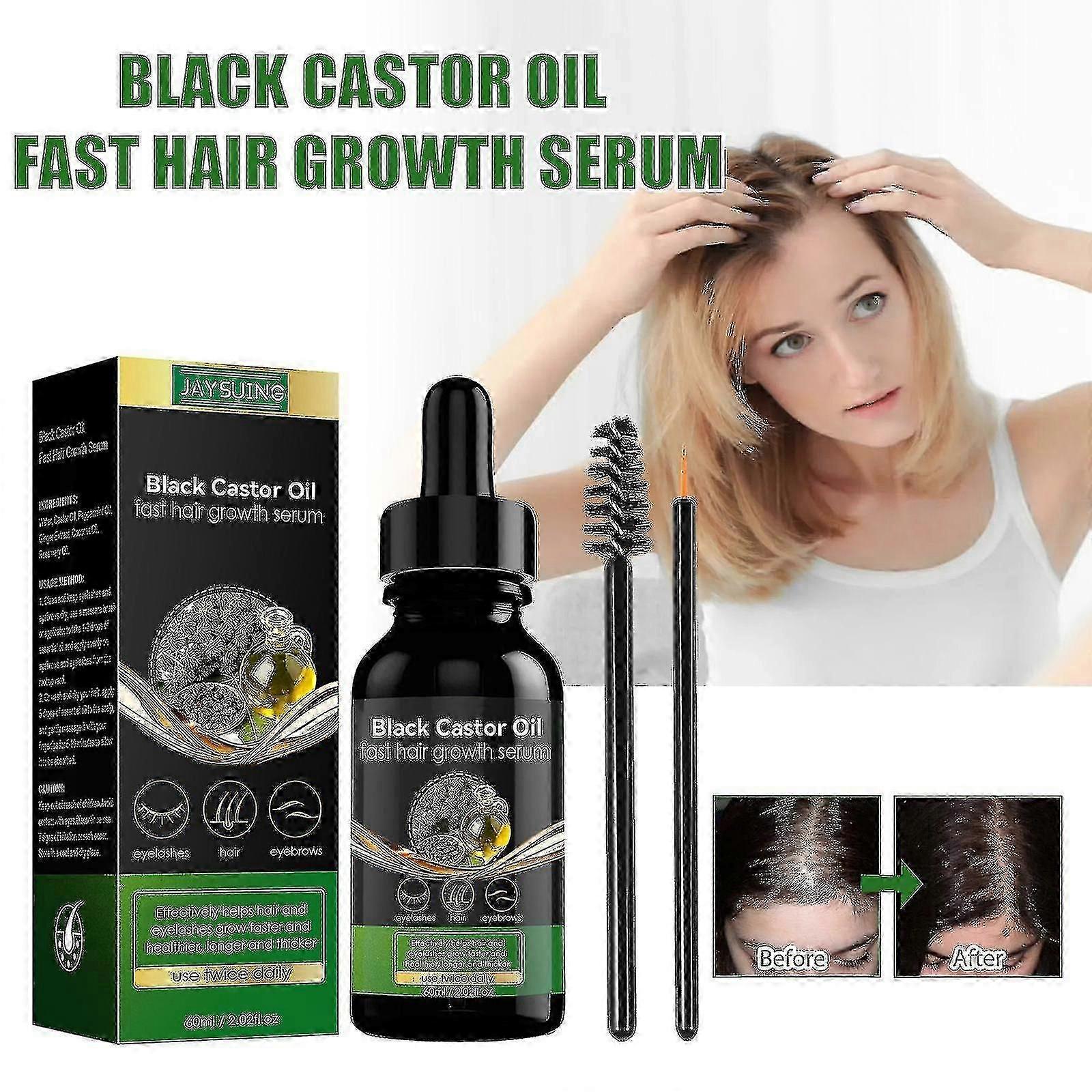 Jaysuing שמן קיק מסמיך סרום לשיער מזין שיער חזק ומוצק מעבה נגד נשירת שיער פתרון טיפוח שיער BF | |