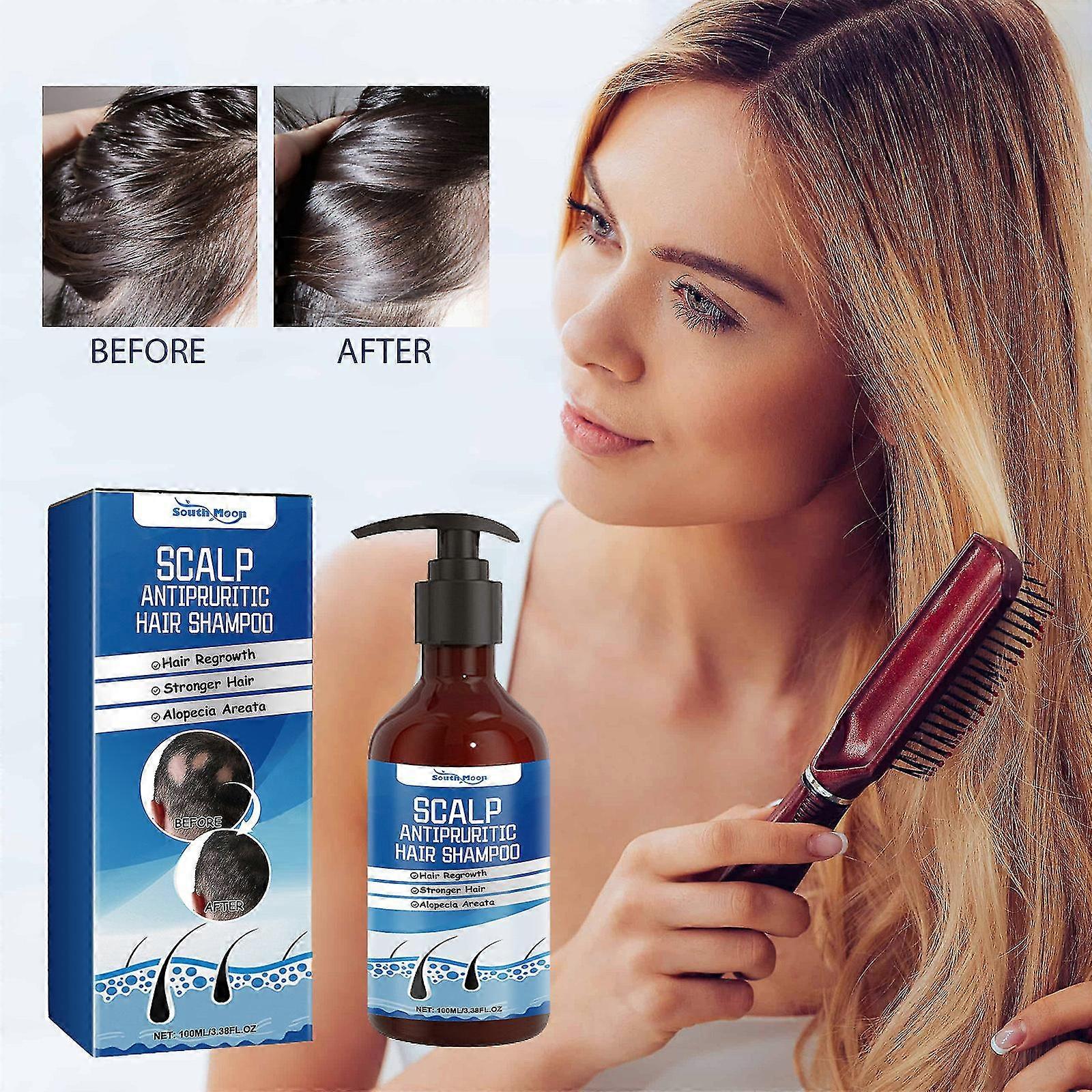 Scalp Anti-Dandruff and Antifungal Shampoo - Treats Folliculitis, Seborrheic Dermatitis