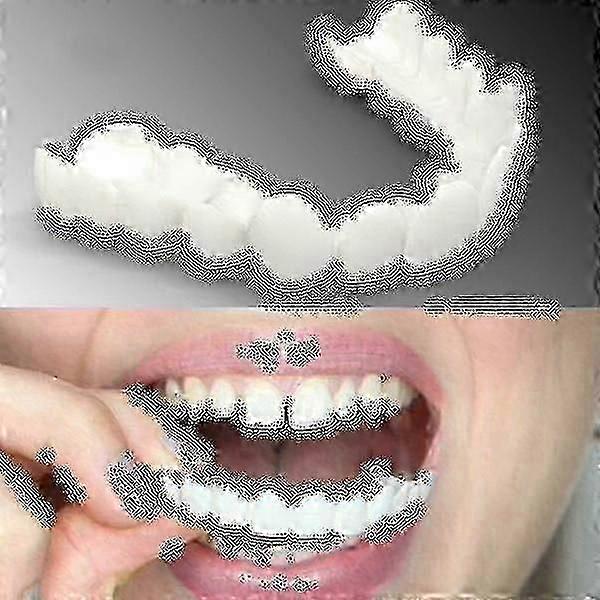 Upper/lower Comfort Fit Flex Whitening Denture Braces