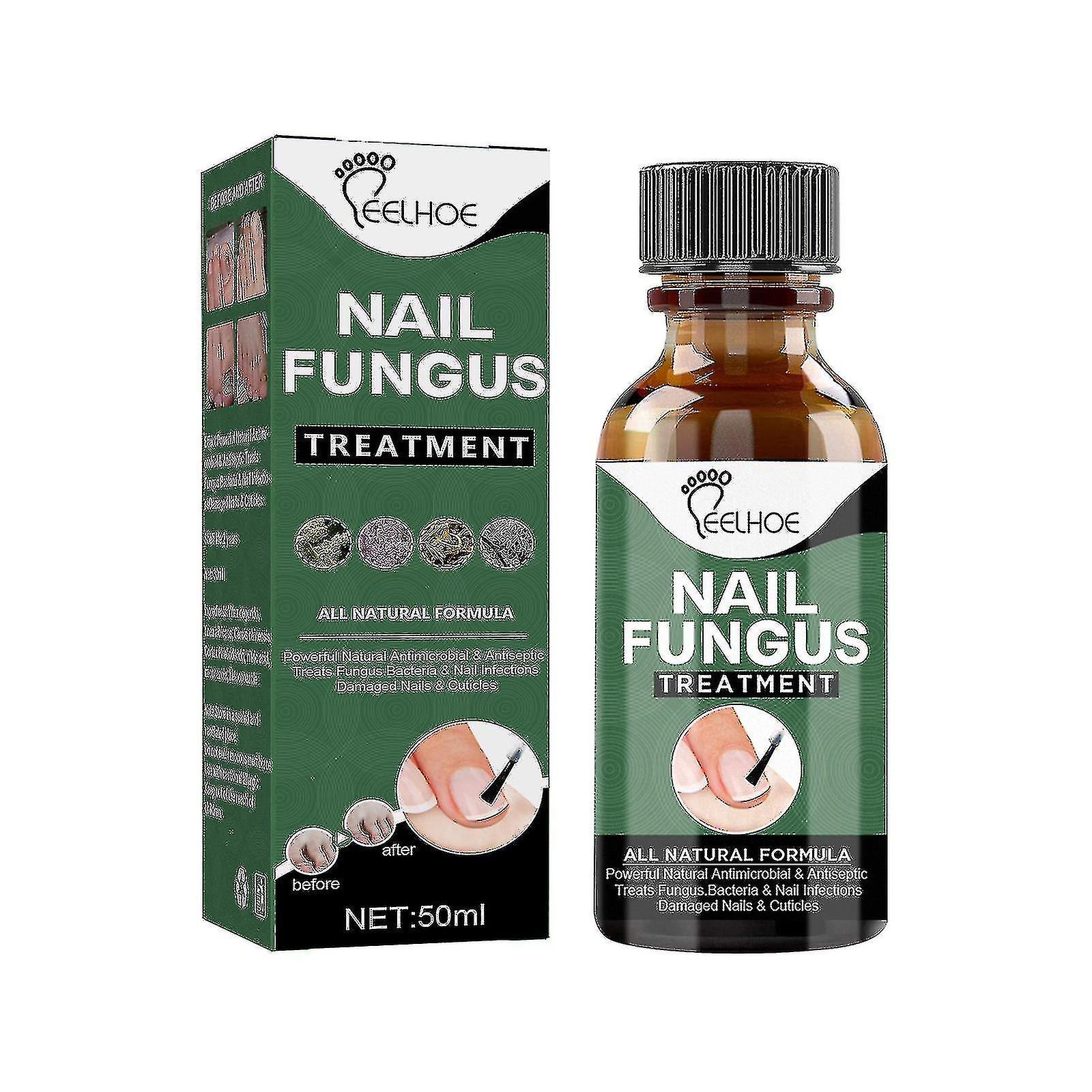 Fungus Treatment, Stop Effectiv