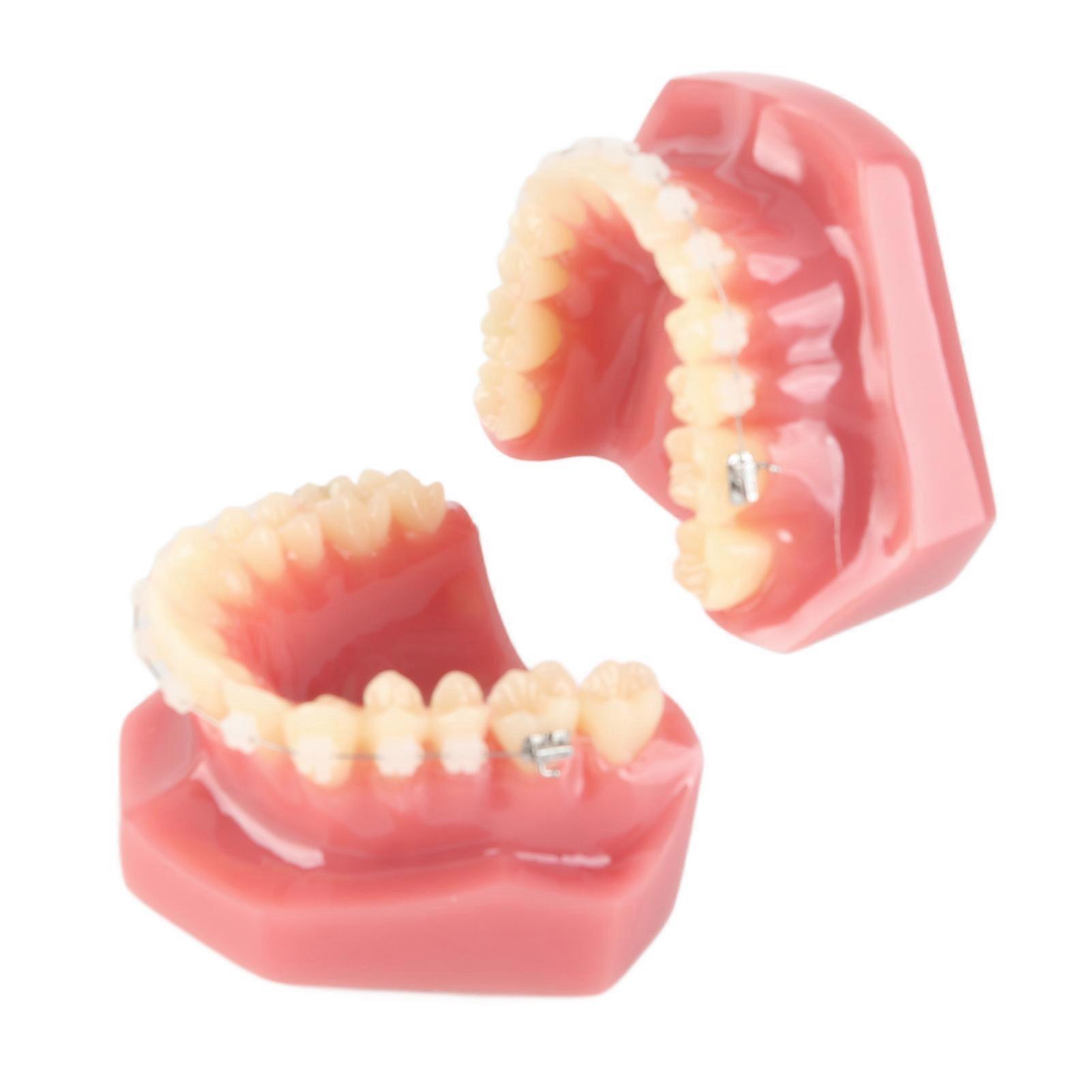 Ceramic Dental Orthodontics Demonstration Model, Teeth Model with Metal Wires and Stand for Teaching and Learning