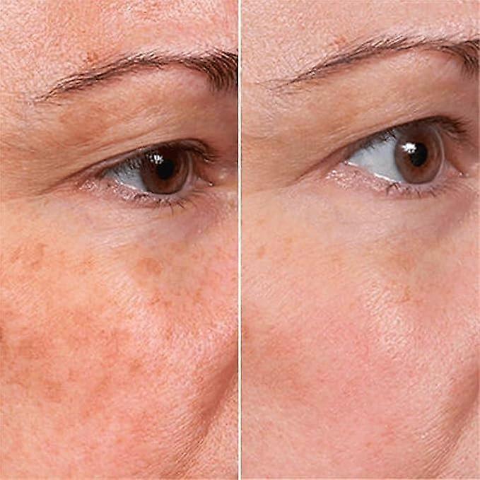 Resurfacing Face Serum main image 0