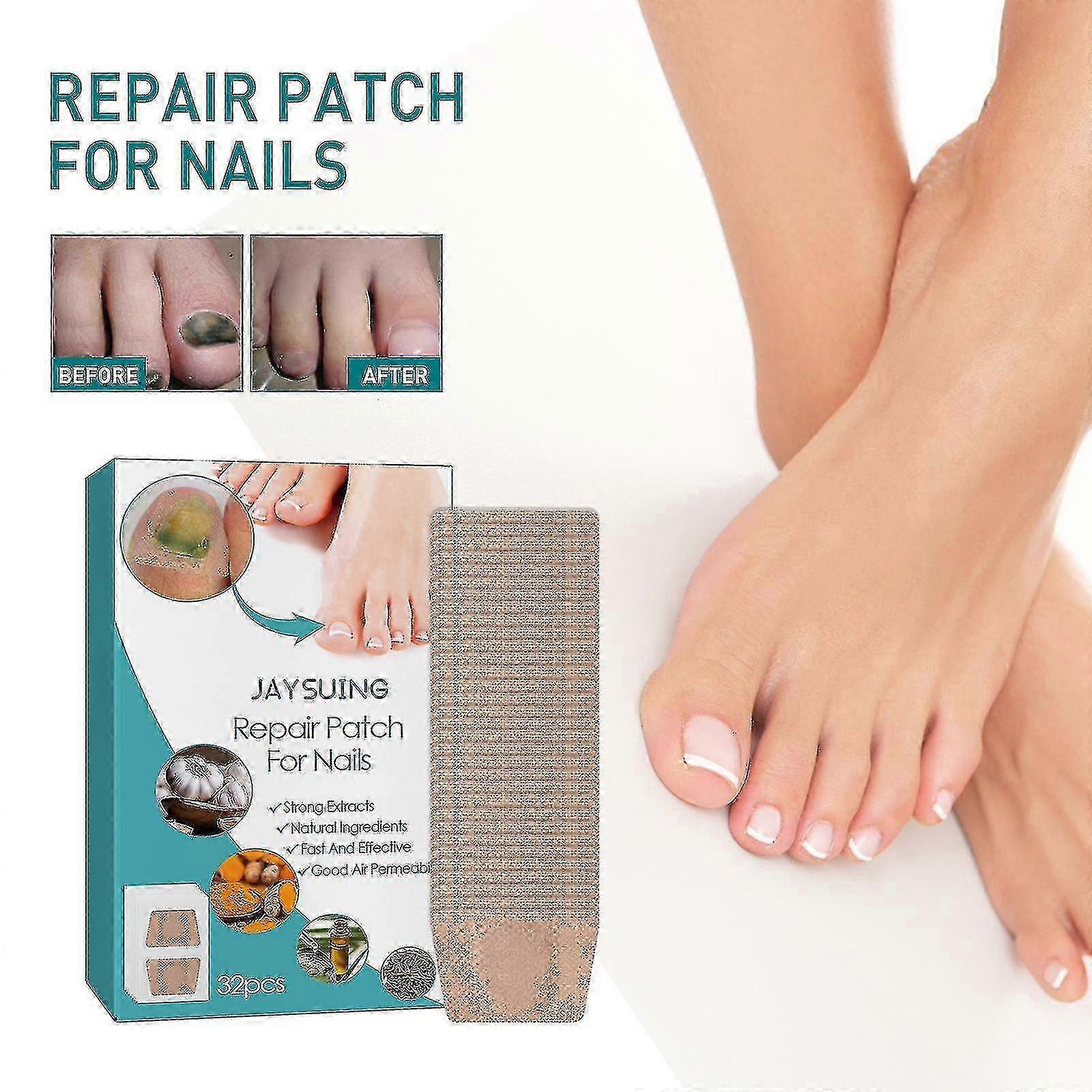 Jaysuingネイルリペアパッチハンド&フットネイルケアソフトネイル陥入足爪肥厚ブライトネイル爪爪パッチBF