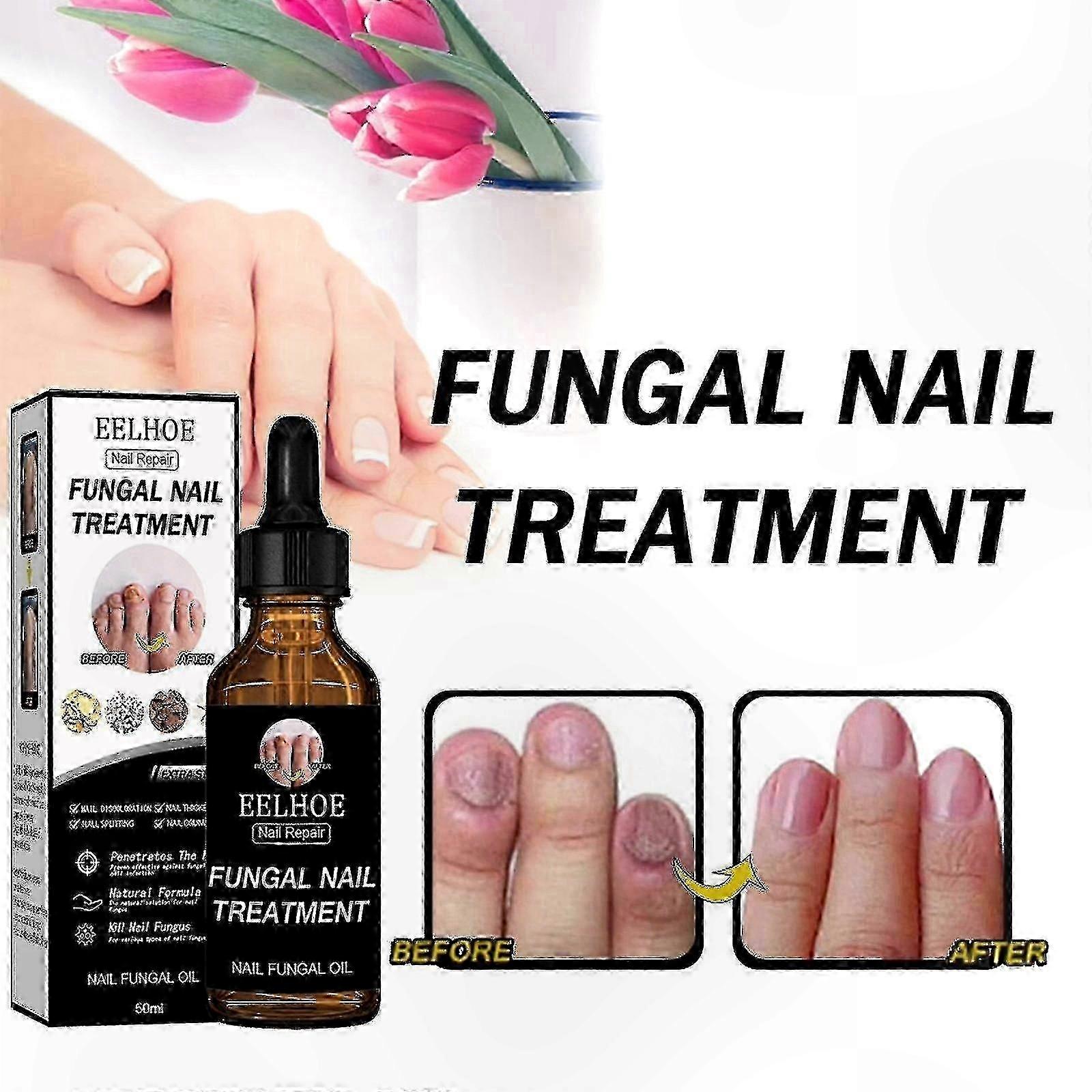 Gray Nail Repair Solution with Thickening Formula and Shining Finish