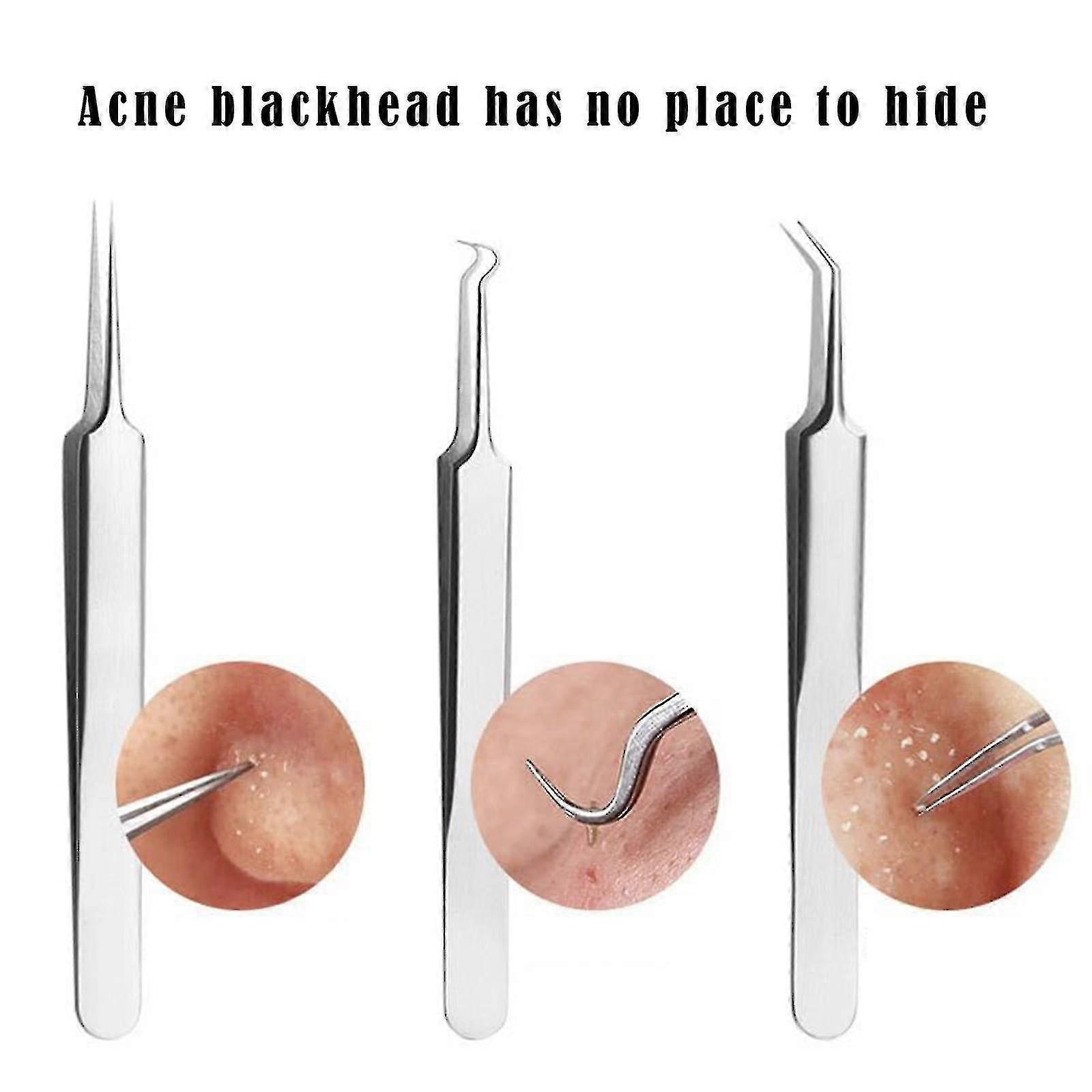 Blackhead Clip Needle Tweezers Pimple Extractor Remover - 3 Types Available-Good