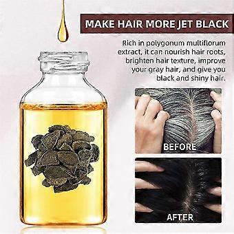 Polygonum Multiflorum Hair Growth Oil Fast Hair Growth Effective Baldness Repair Postpartum Hair Loss Seborrheic Hair Loss