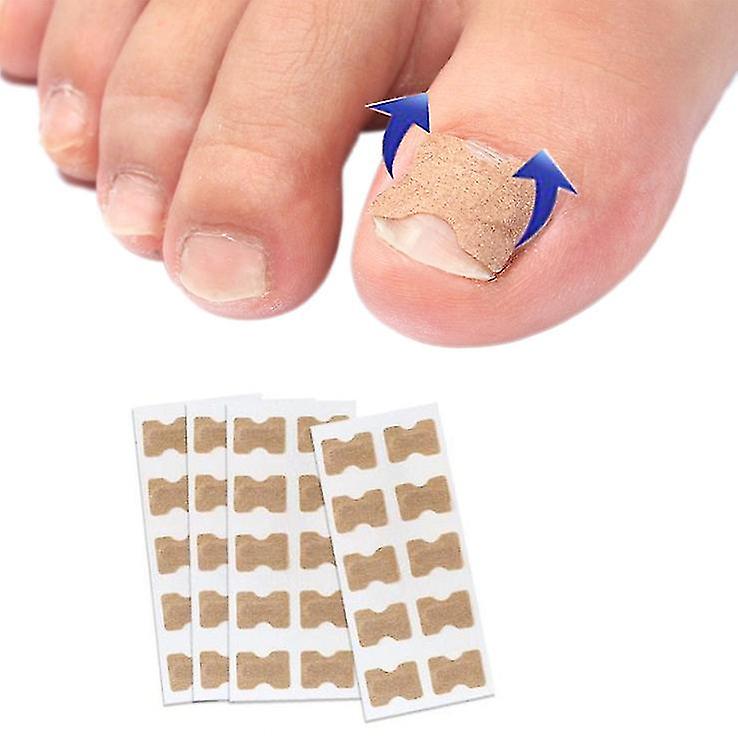 100 Pcs Toenail Correction Patches Glue-Free Pedicure Tool Corrector Toe Nail Ingrown Patch
