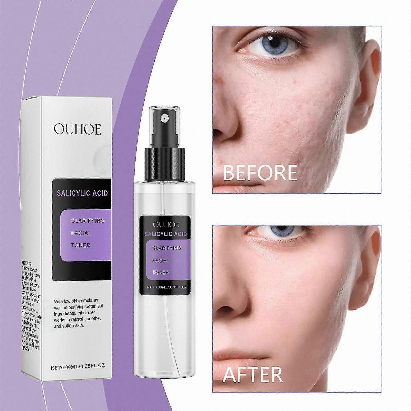 Clarifying Facial Toner with AHA/BHA, Exfoliating Spray for Whiteheads, Pores, and Uneven Skin Texture