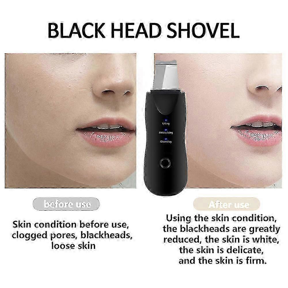 Ultrasonic Skin Scrubberblackhead Remover Electric Pore Cleanernano 