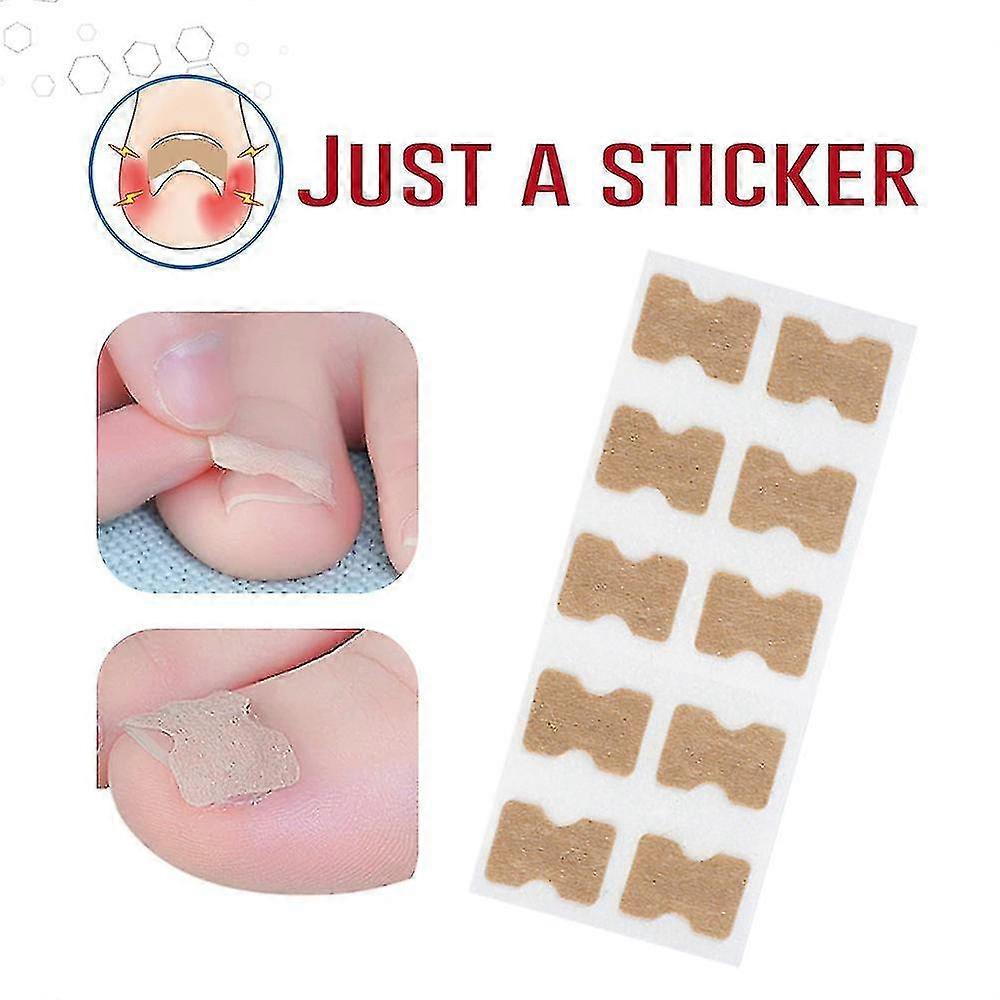 10/50pcs Toenail Correction Patch Corrector Pedicure Tools