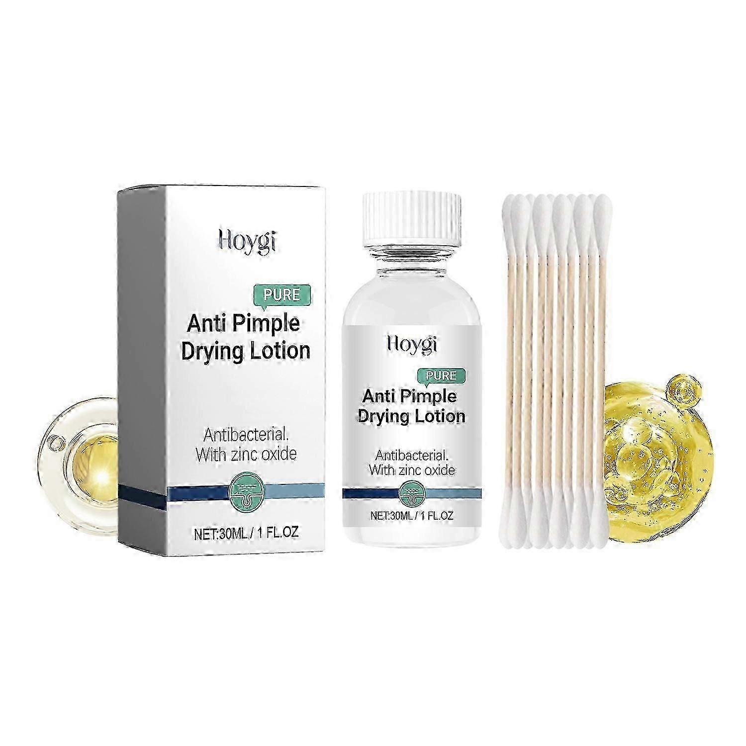 Hoygi Anti-Pimple Drying Lotion, Facial Cleansing And Repair Lighten Acne Marks And Pits, Close Your
