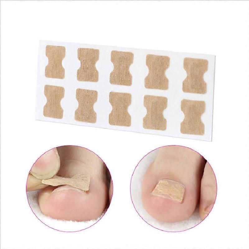 Ingrown Toenail Stick Patch,glue-free Toe Nail Correction File Patch Paronychia, 10PCS