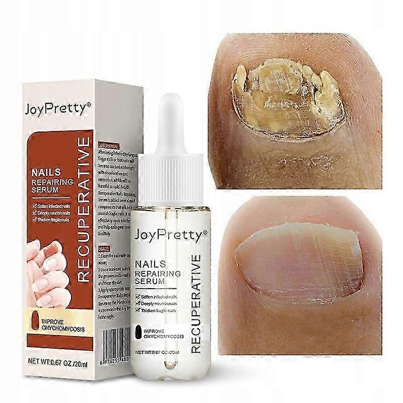 Onychomycosis Strong Nail Repair Liquid