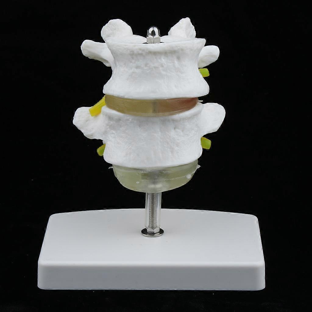 2-Section Life-Size Human Lumbar Vertebrae Model with Base Medical Teaching