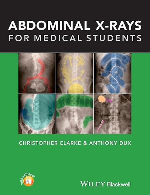 Abdominal Xrays For Medical Students by Anthony University Hospitals of Leicester Dux Paperback Book