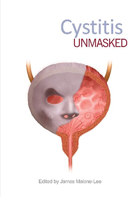 Cystitis Unmasked by TFM Publishing Ltd Paperback