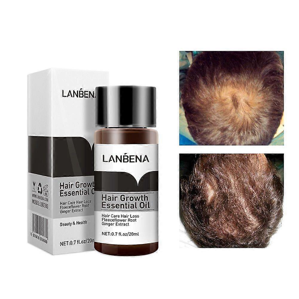 Traitement anti-perte d’essence pour la croissance des cheveux