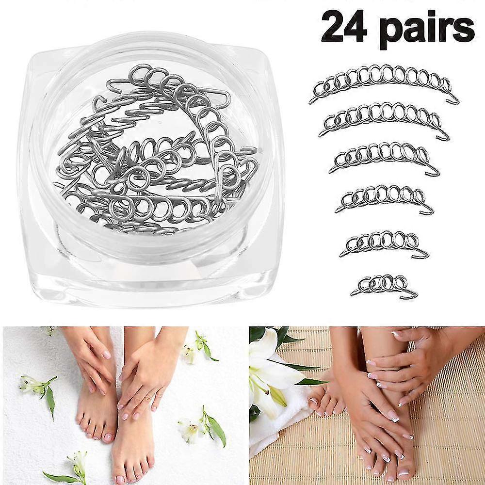 Ingrown Toenails Correction Wire  Foot Pedicure Tool 24pairs