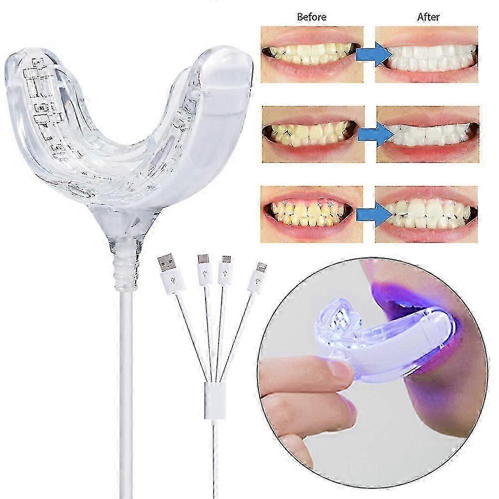 Professional Teeth Whitening Kit, Advanced Blue Led Light, Smartphone Adapter_Featured Gift