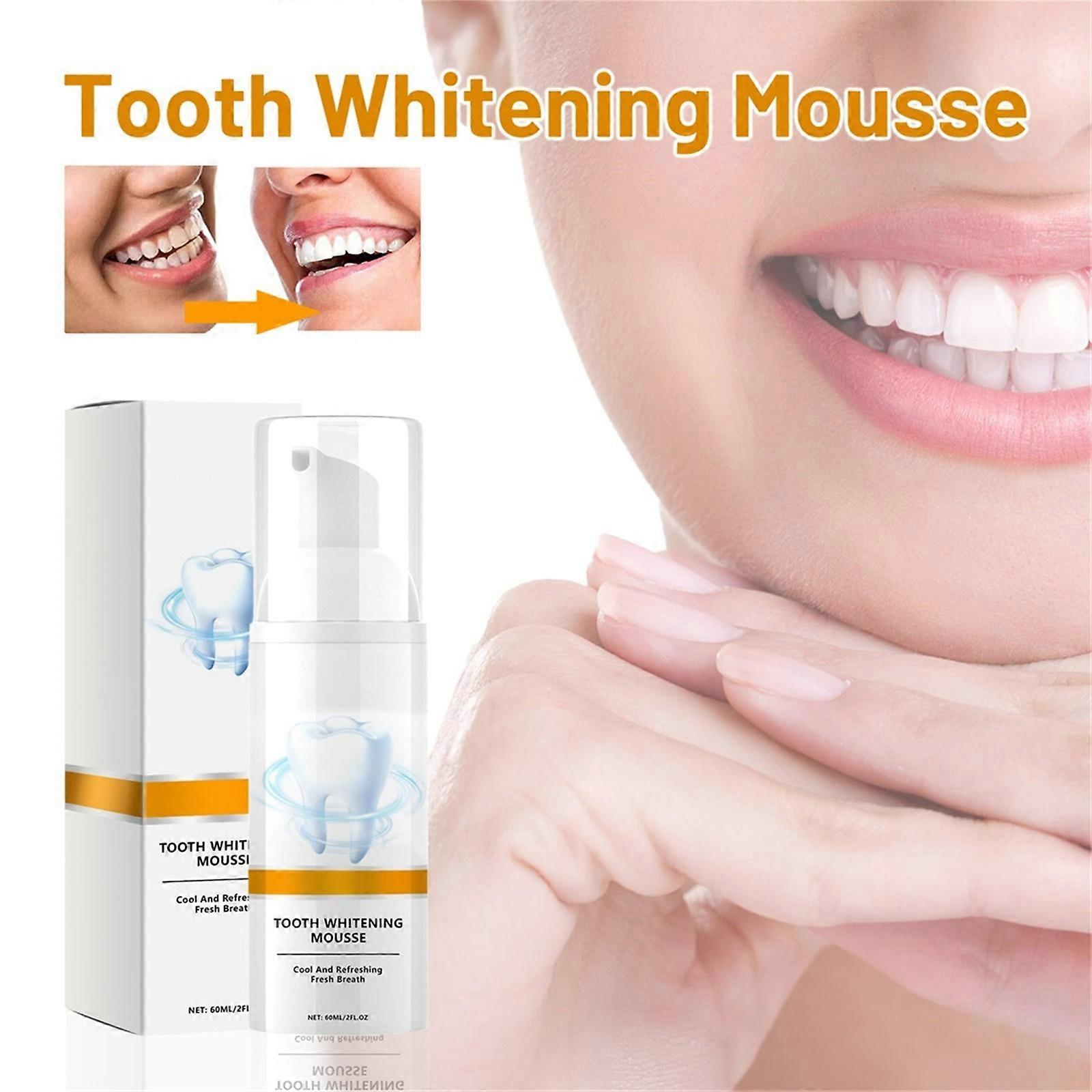 Zahnaufhellung und Fleckenentfernung