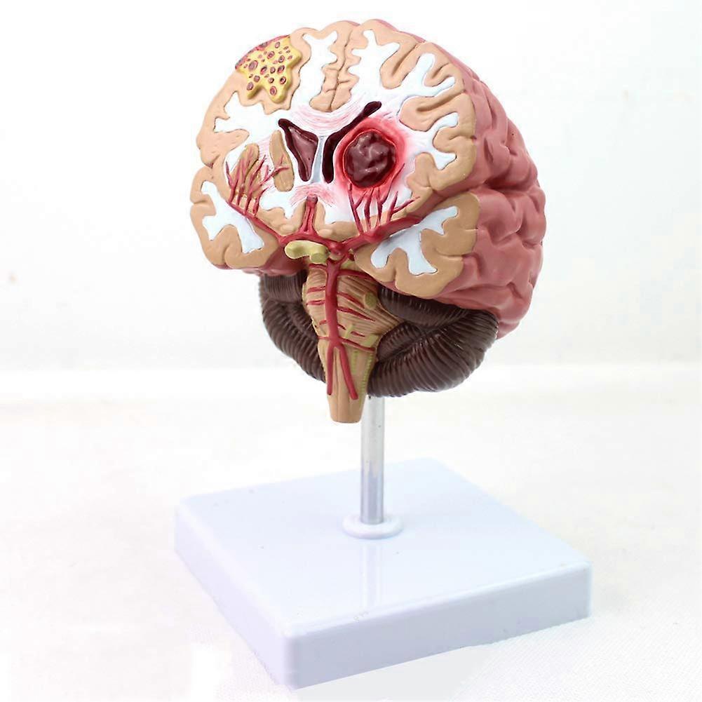 Life Size Human Brain Model, 8Part Anatomical Design with ColorCoded Regions and Display Base