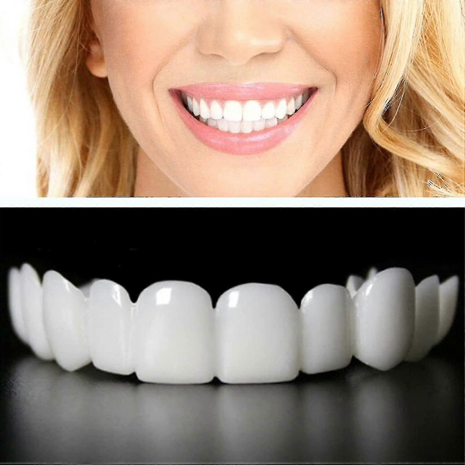 Upper & Lower Teeth Veneers - 2 Pairs Simulation Braces Sp On Veneers Smile Fake Teeth Cover Imperfect Teeth Perfect Whitening False Teeth One Size De