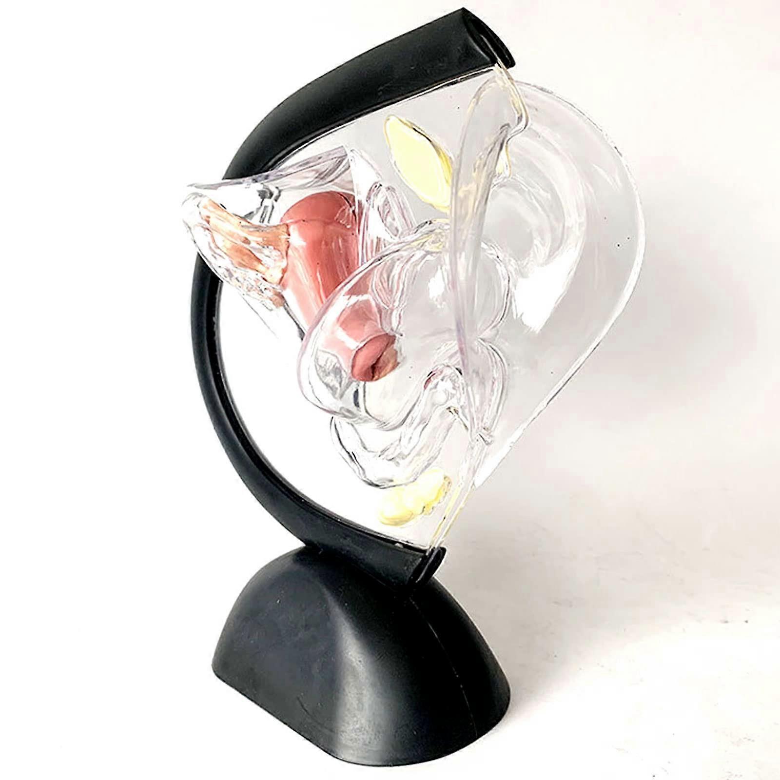 Transparent Pathological Uterus Model with Removable Uterine Ring Structure for Visceral Anatomy Teaching and Reproductive System Demonstration