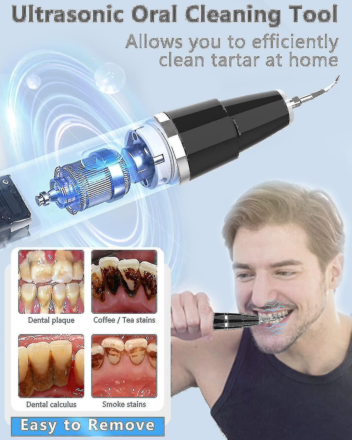 Dental Remover Ultrasonic Tooth Tools