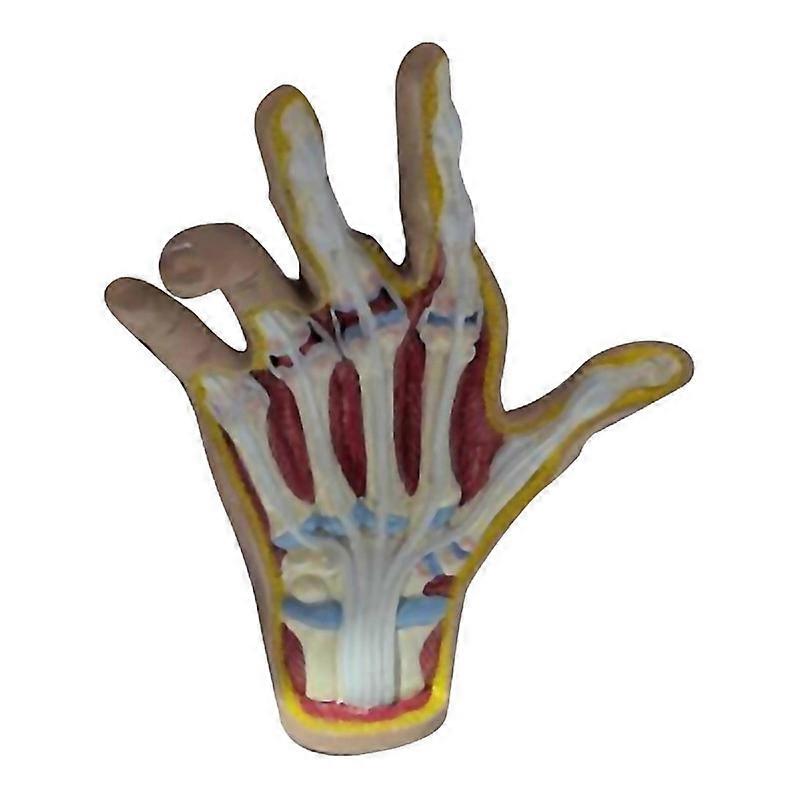 For Osteoarthritis Hand Model Model Of Hand Pathology