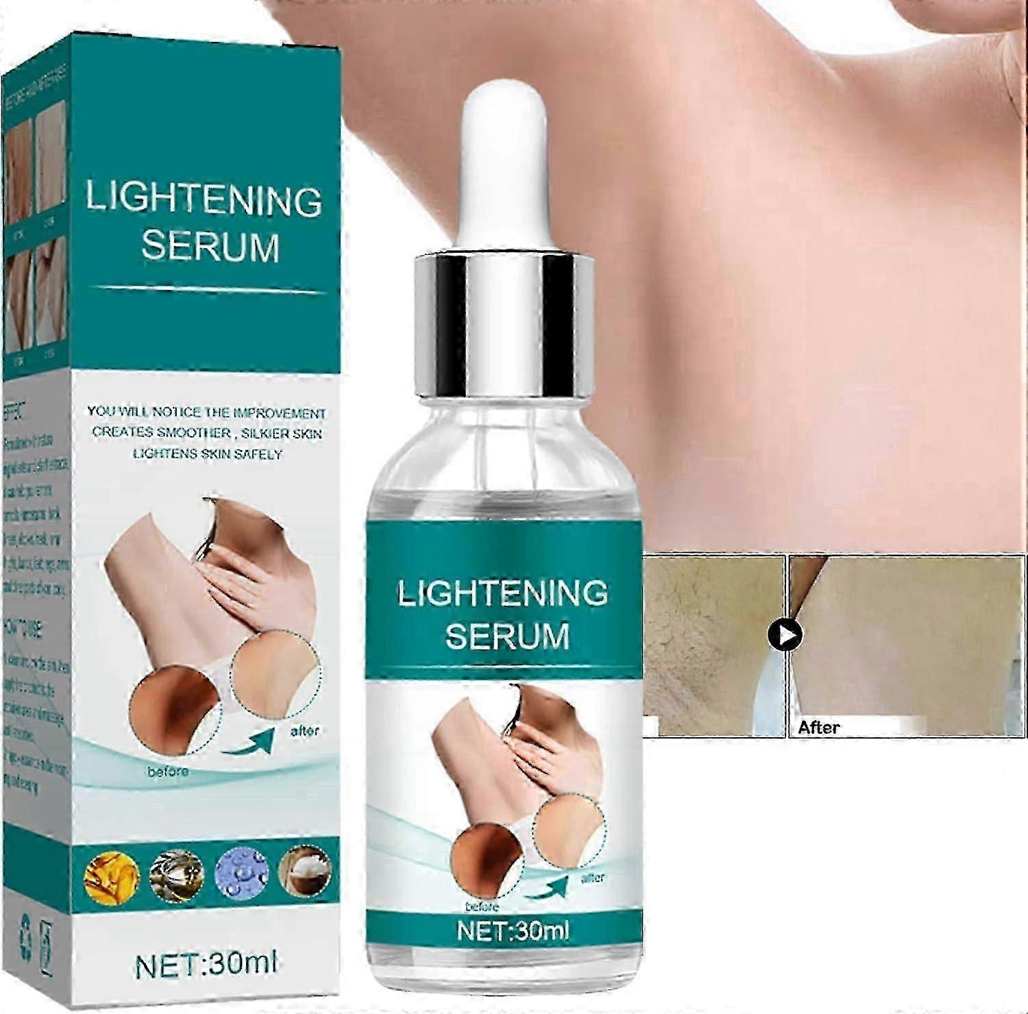 Achselaufhellungsseren, Knieaufhellungsserum, Achsel-Anti-Pickel-Seren, Körperaufhellungsserum 30ml