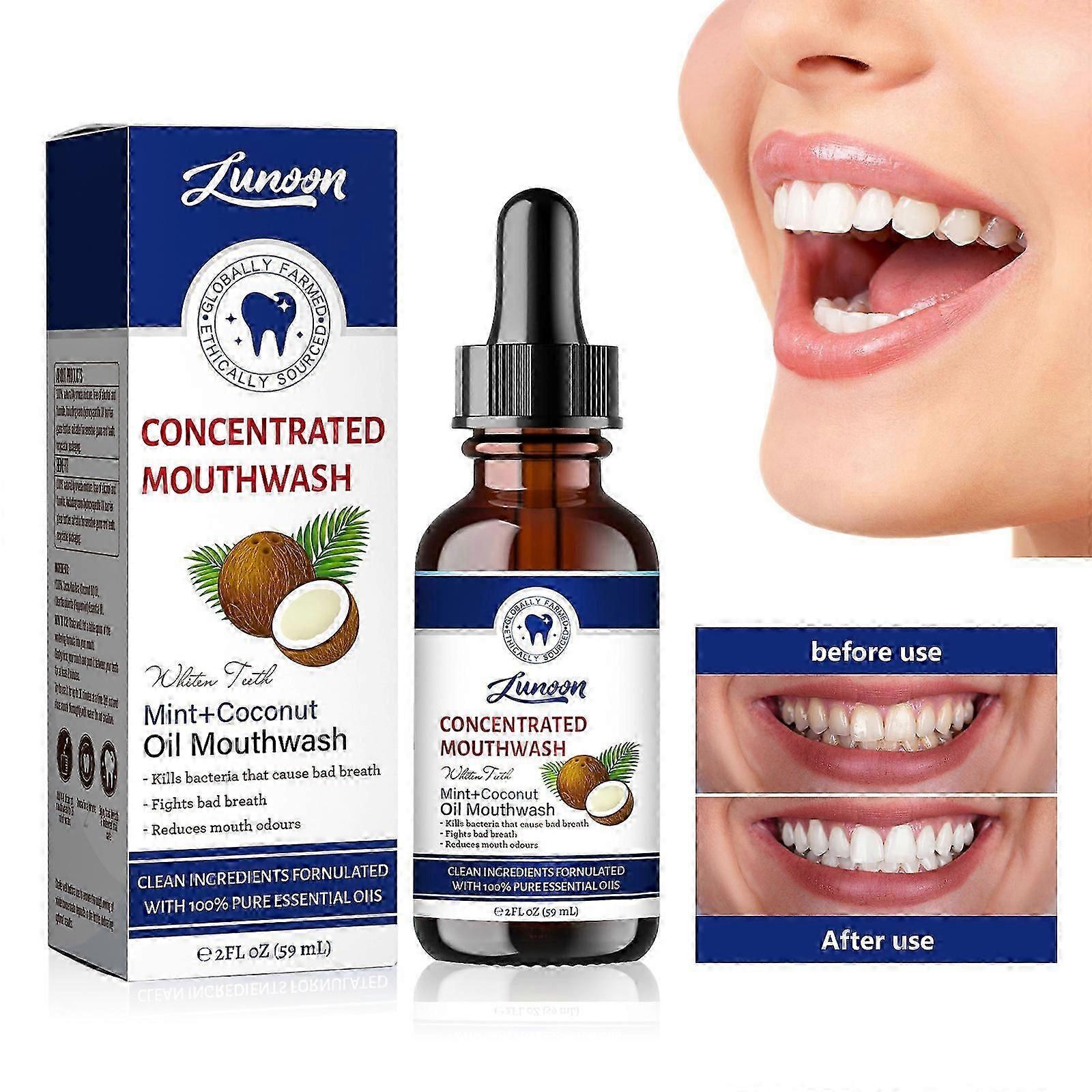濃縮うがい薬(2液量オンス)、フッ化物フリー、天然エッセンシャルオイル入りミントうがい薬、300リンスをサポートし、新鮮な息を助けます