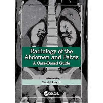 Radiologi af abdomen og bækkenet En casebaseret guide