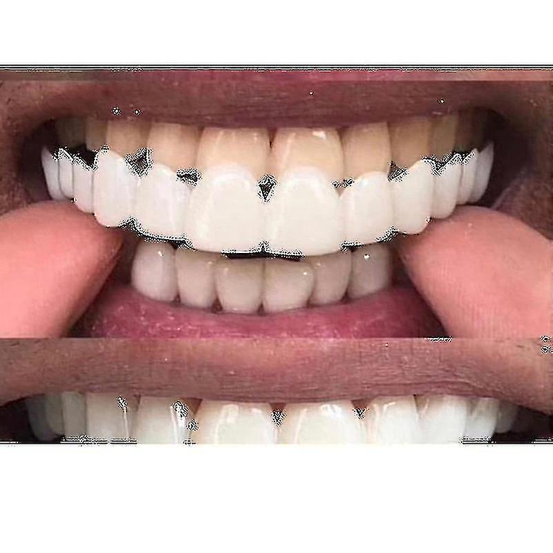 Nový snap na Smile Zubné falošné zuby Kryt Úsmev Dyhy Pohodlie Fit Flex Zubné protézy Zuby