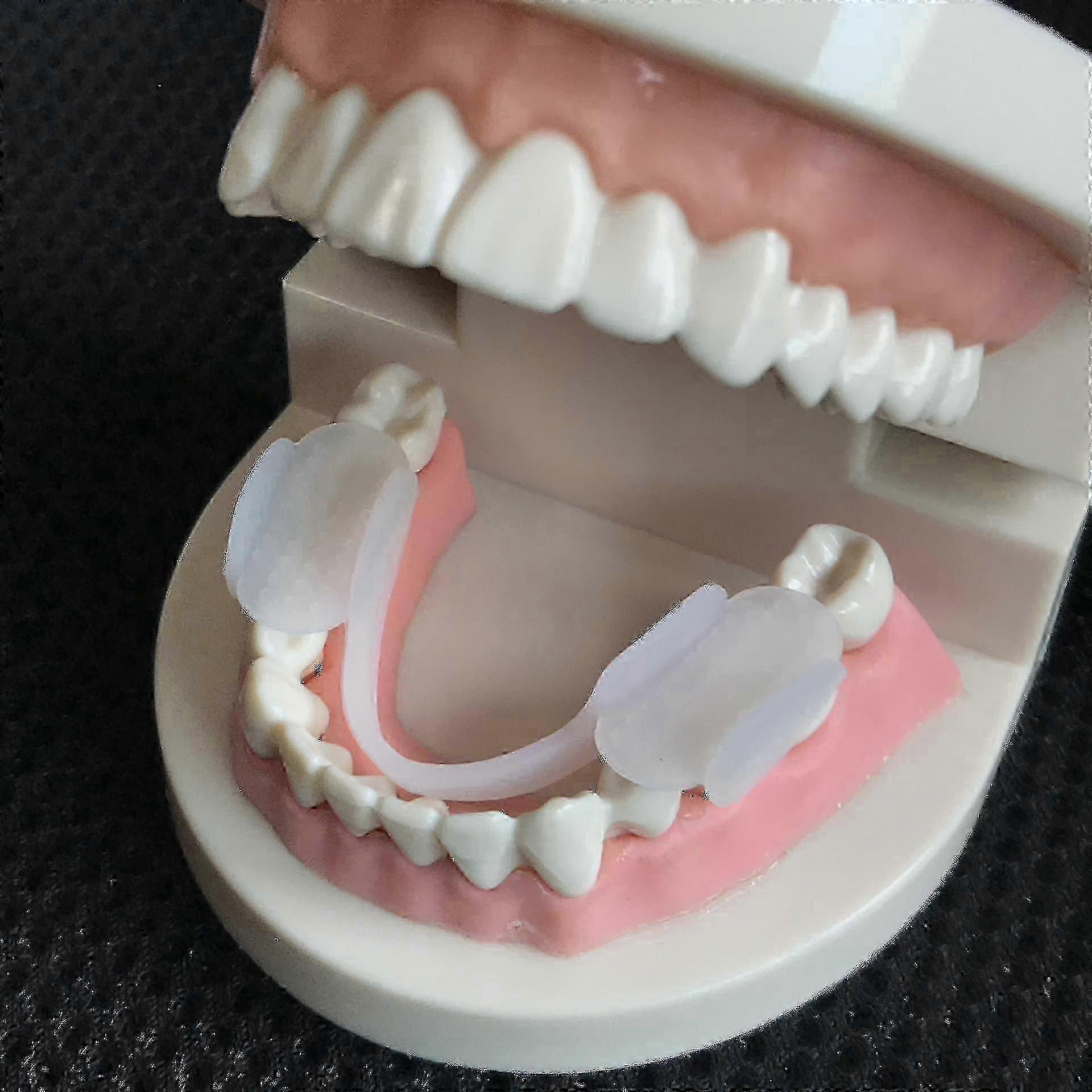 Bruxism Mouth Guard Sleep Mouthguard Splint Clenching Dental Braces Alignment Trainer Sleep Aid Teeth Protector Tools Ls