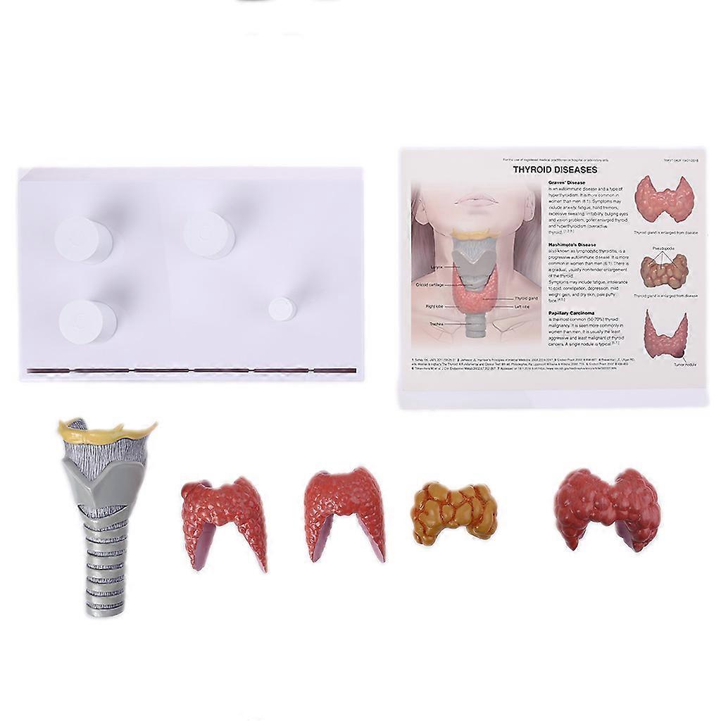 Menschliche Anatomische Schilddrüse Modell Pathologie Anatomie Verdauungssystem Display
