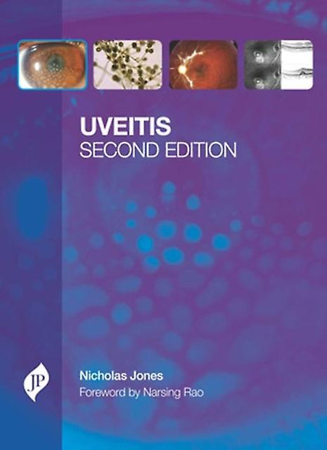 Uveitis by Nicholas P Jones Paperback Book