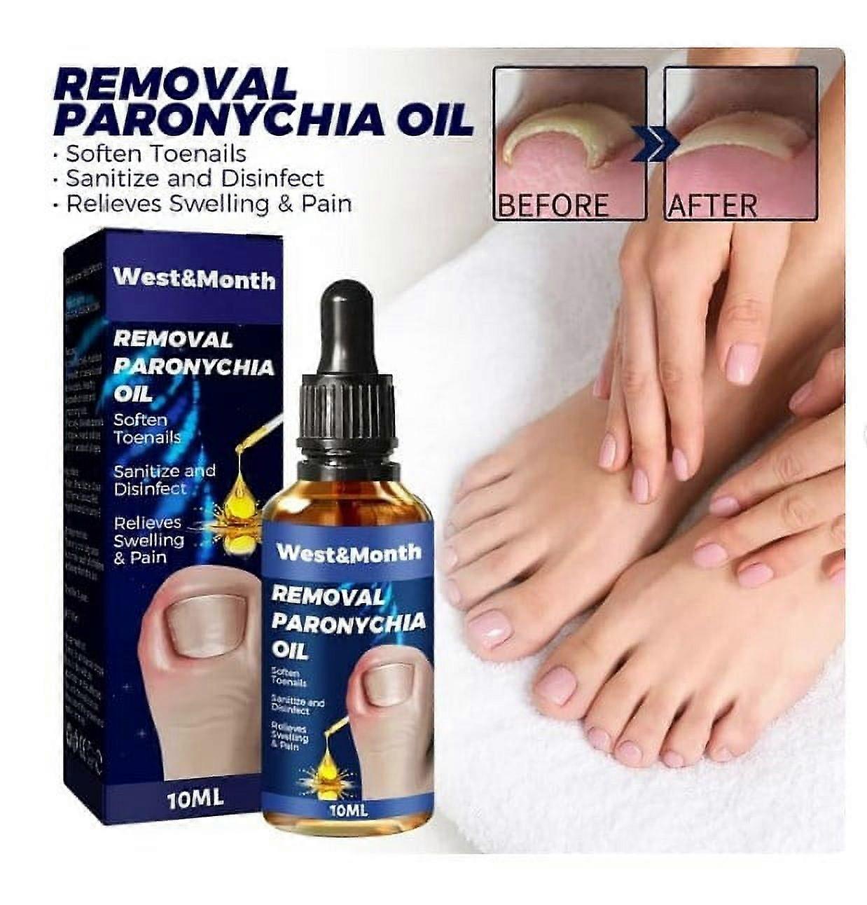 爪周囲炎、ネイルケアと治療、健康な足と手のためのネイルケアのためのドイツの足の爪のケアオイル10ml