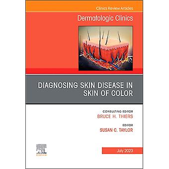 Diagnosing Skin Disease In Skin Of Color An Issue Of Dermatologic Clinics - Elsevier - Health Sciences Division