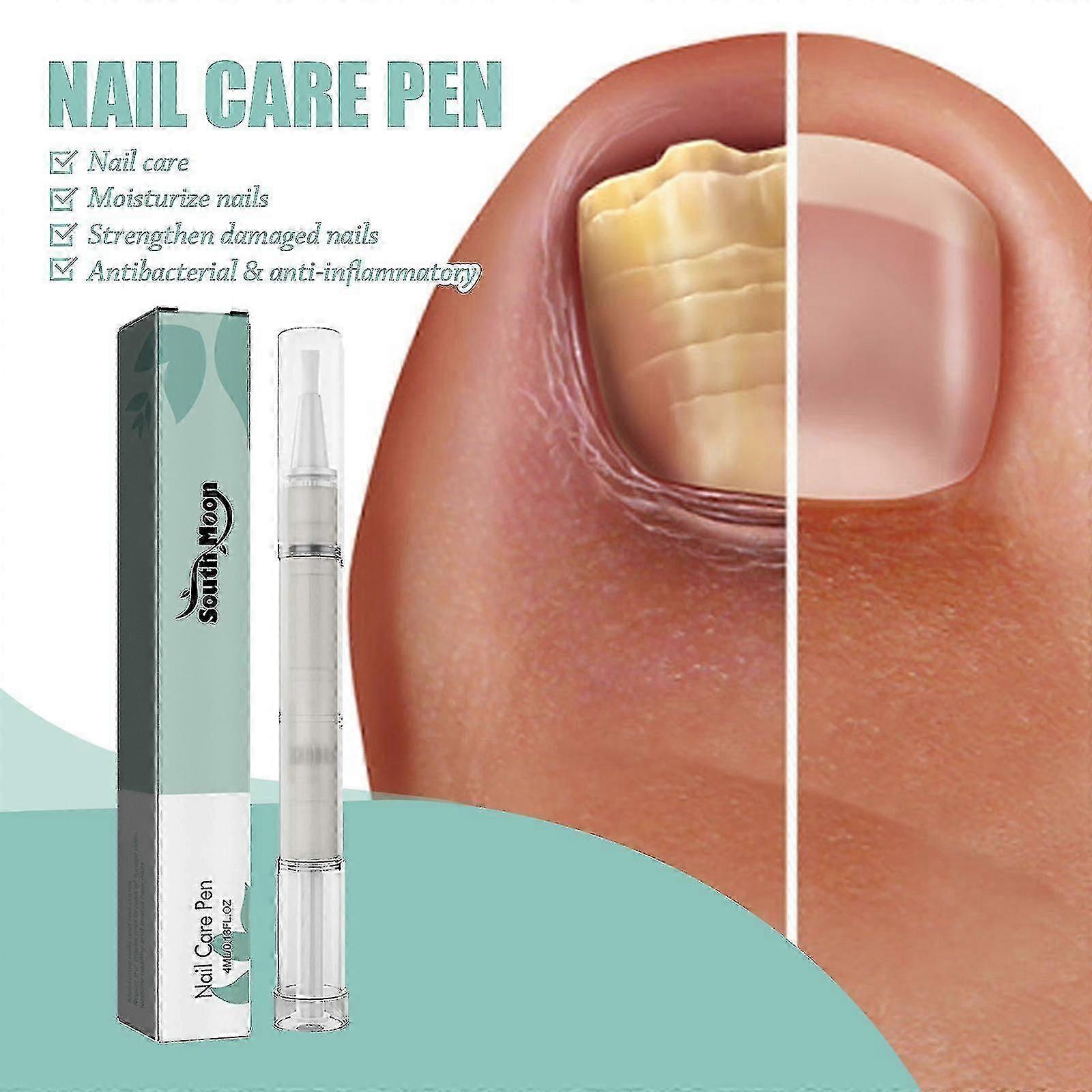 死んだ皮膚やとげのある灰色の爪を取り除くためのサウスムーンネイルリペアペン、栄養と栄養のあるネイルリペアペンGBN GSL、ハッピーH