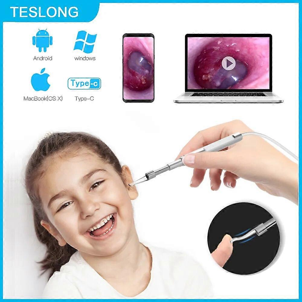 TESLONG 3 in 1 Ear Endoscope Camera 4.3mm Ear Cleaning Tool HD Visual Ear Spoon Earpick TYPE-C Android PC Otoscope 6 Leds