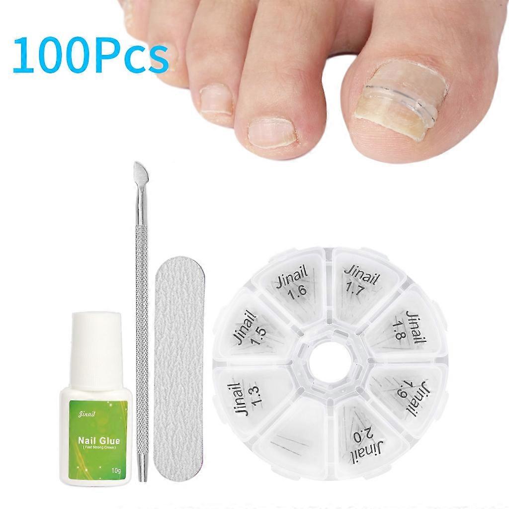 陥入爪ツール矯正クリップカーブブレース爪周囲炎矯正ツール